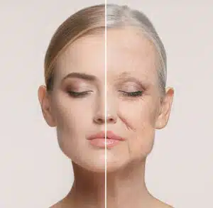 Ablative CO2 laser resurfacing treatment at a specialist UK clinic