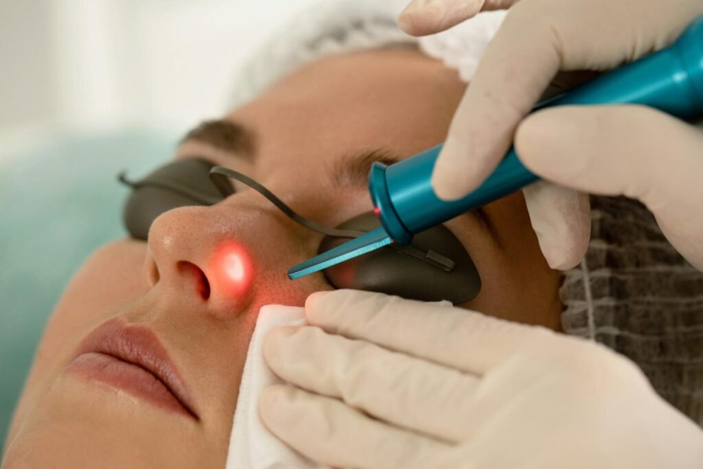 CO2 laser Manchester treatment at a verified aesthetic clinic