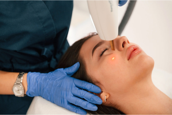 Lady have CO2 laser resurfacing on her face